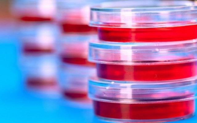 Χαμηλός αιματοκρίτης: Πού οφείλεται και τι υποδηλώνει