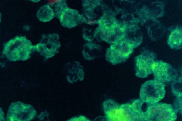 ΗΠΑ: Αμοιβάδα που «τρώει» τον εγκέφαλο εντοπίστηκε σε πόσιμο νερό! (video)