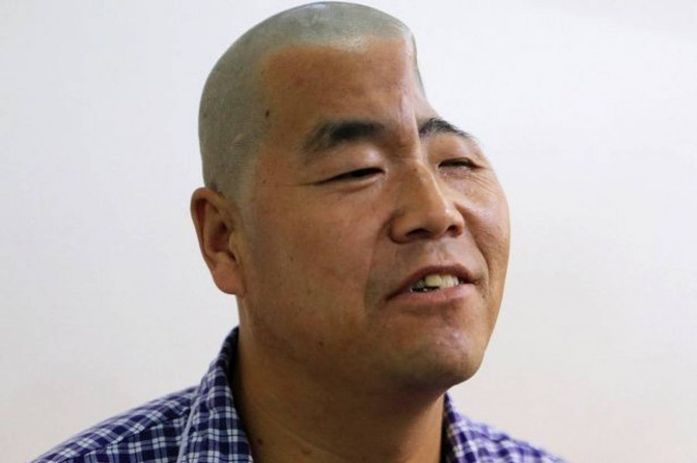 Κίνα: Εκτυπωτής 3D τού έδωσε πίσω το μισό του κρανίο! (photos)