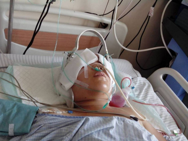 Σκληρές εικόνες: Της έφυγε ολόκληρο το δέρμα από το κεφάλι