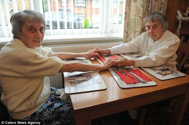 Δίδυμες αποφάσισαν να χωρίσουν μετά από 96 χρόνια (pics)