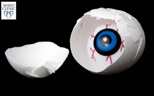 Κόκκινα μάτια: Πού μπορεί να οφείλεται το σύμπτωμα (λίστα)