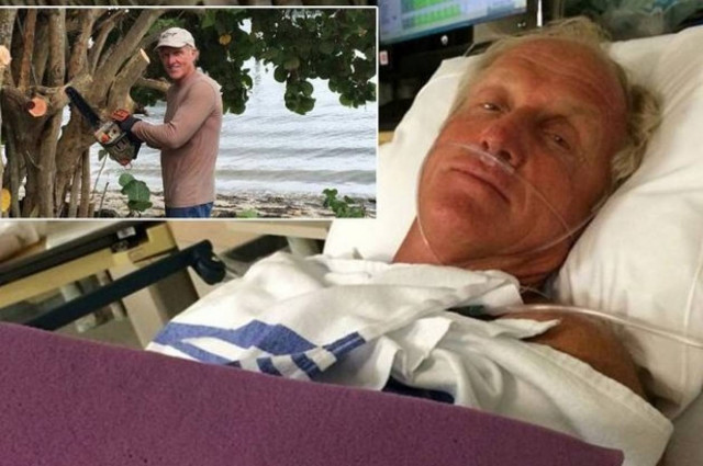 Γνωστός πρωταθλητής του γκολφ παραλίγο να χάσει το χέρι του από αλυσοπρίονο