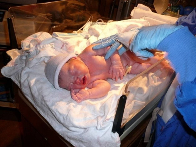 Ένα εκατομμύριο παιδιά «σβήνουν» λίγο μετά τη γέννησή τους