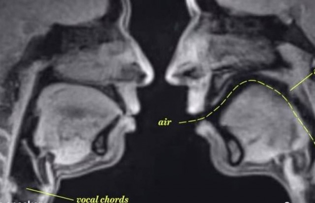 Τομογράφος παρουσιάζει το σεξ όπως δεν το έχετε ξαναδεί (vid)
