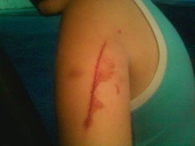 Πάτρα: Σοβαρή καταγγελία μητέρας - «Αστυνομικός χτύπησε το παιδί μου»