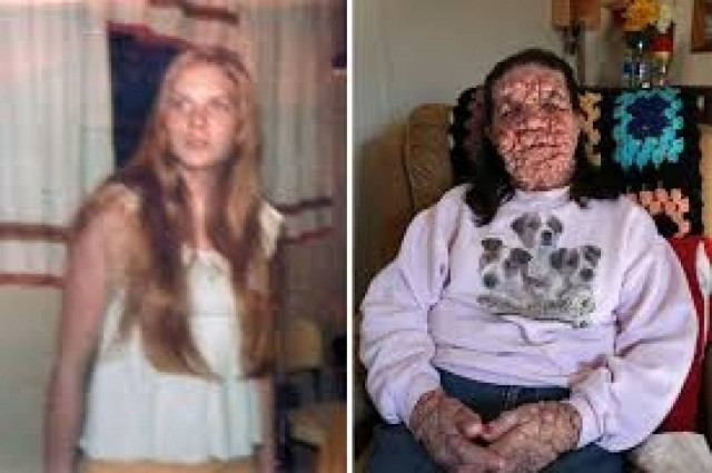 Τραγικό: Το πρόσωπο της είναι γεμάτο φουσκάλες (σκληρές εικόνες)