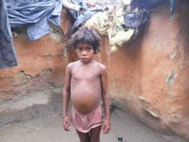 Παιδί θήλαζε από σκύλους (pics)