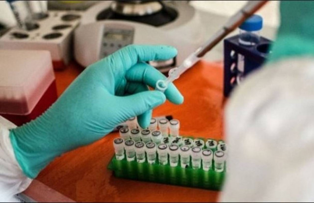 Υπουργείο Υγείας: Ευρεία σύσκεψη για τον Έμπολα