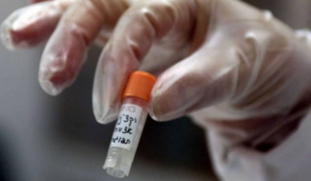 Ρωσία: Διαθέσιμα εμβόλια για τον Έμπολα σε 6 μήνες