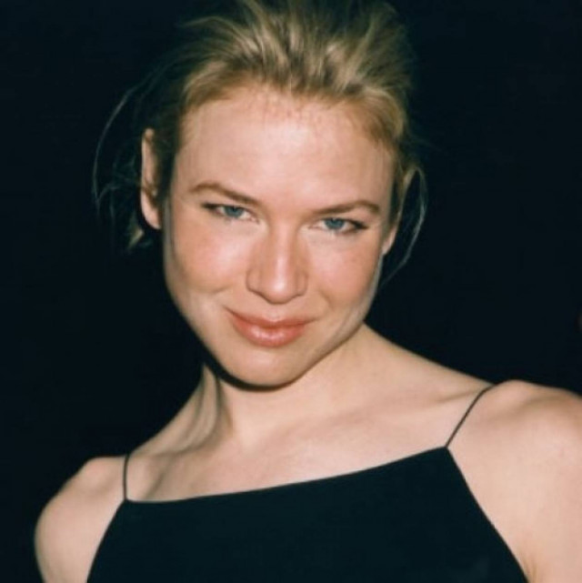 Όχι δεν είναι δυνατόν! Η Renee Zellweger άλλαξε πρόσωπο