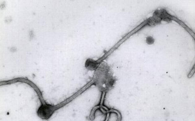 ΠΟΥ: Έρχεται ορός με αντισώματα κατά του Έμπολα