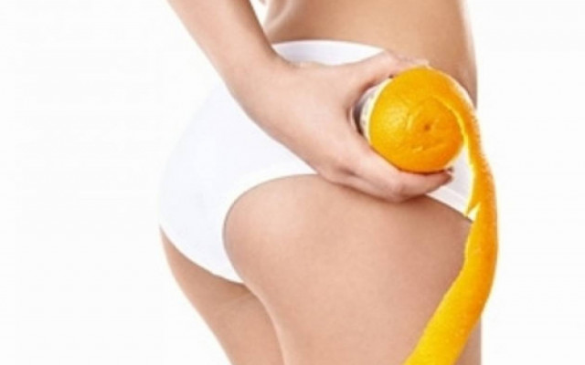 Κυτταρίτιδα: Δύο απλές ασκήσεις που θα τη «σβήσουν» από το σώμα σας