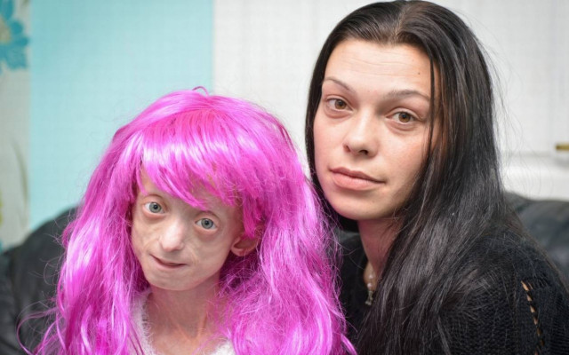 Δάσκαλοι ζήτησαν από άρρωστη μαθήτρια να βγάλει την περούκα της