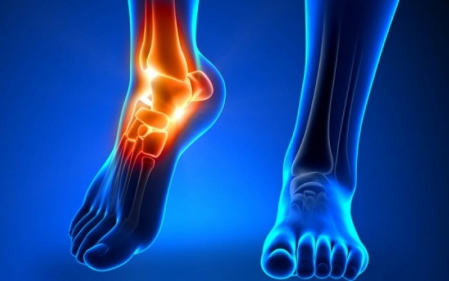 Ο χυμός που διαλύει το ουρικό οξύ στις αρθρώσεις