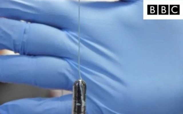 Οισοφάγος Barrett: Διάγνωση με μικροσκοπικό χάπι-σφουγγάρι