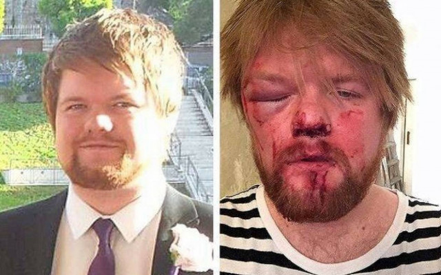 Σκωτία: Πήγε για πίτσα αλλά έφαγε... ξύλο!