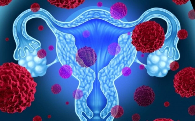 Τα 8 πιο κοινά σημάδια του καρκίνου των ωοθηκών