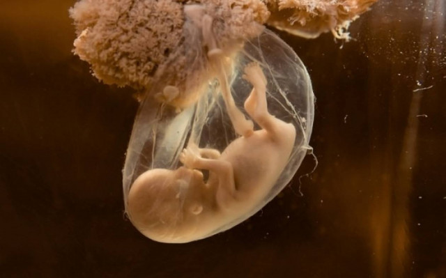 Η εκσπερμάτιση - η γονιμοποίηση - η εγκυμοσύνη σε ένα βίντεο