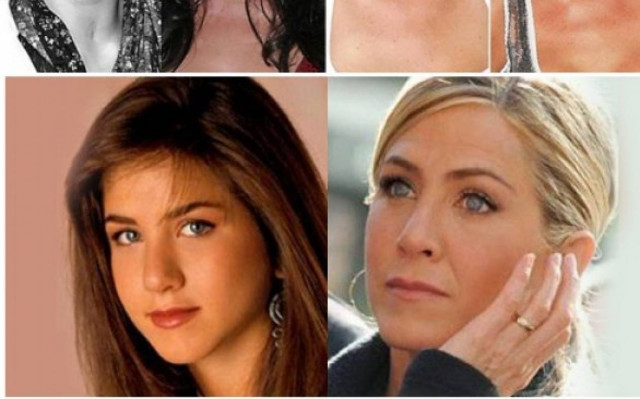 Ουπς: 16 stars πριν και μετά τις πλαστικές επεμβάσεις!