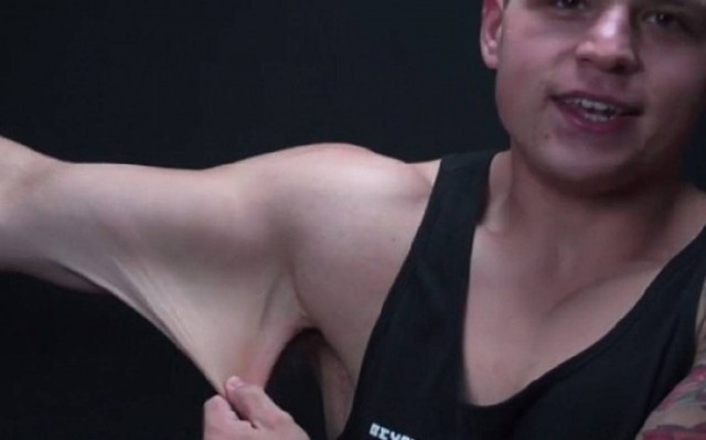 Δείτε πώς έγινε το δέρμα του αφού έχασε 70 κιλά