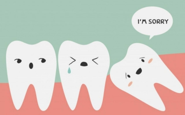 Εξαγωγή φρονιμίτη: Πότε πρέπει να γίνεται και γιατί