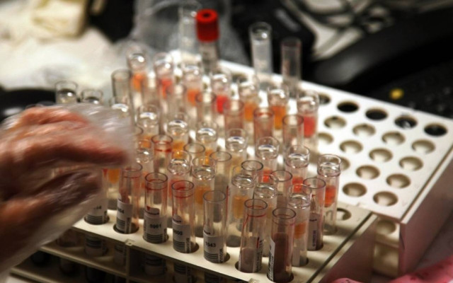 Επιμένουν στην επίσχεση από 1/12 διαγνωστικά και κλινικές