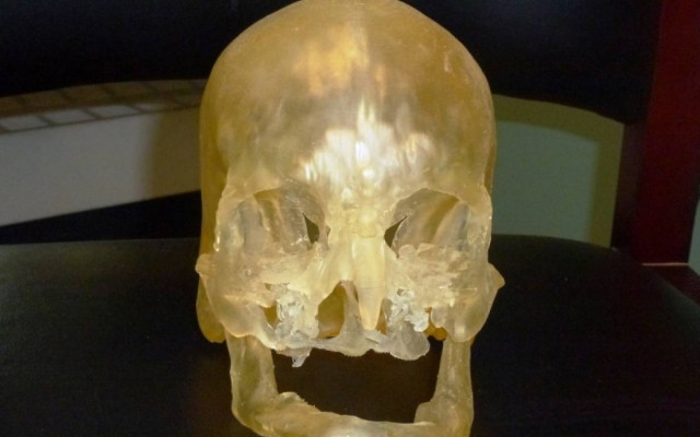 Επανάσταση στις επεμβάσεις προσώπου με 3D ψηφιοποίηση