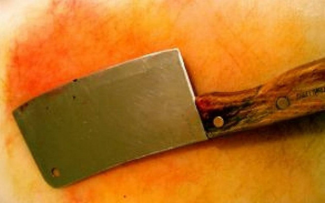 Μαλαισία: Ζηλιάρης σύζυγος ακρωτηρίασε τη γυναίκα του!