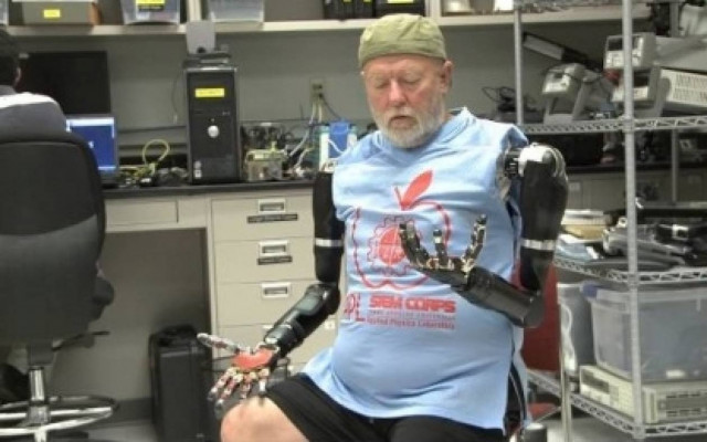 Ο πρώτος άνθρωπος που ελέγχει προσθετικά μέλη με την σκέψη