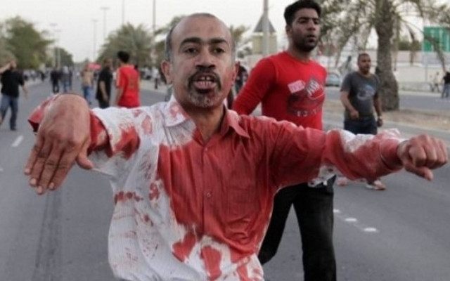 Λιβύη: Συγκρούσεις με νεκρούς και τραυματίες