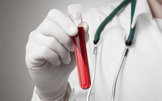 Φρένο στη σκλήρυνση κατά πλάκας από τα βλαστοκύτταρα