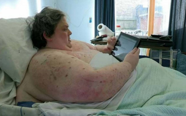 ΣΥΓΚΛΟΝΙΣΤΙΚΟ: Δείτε τις ακτινογραφίες ενός ανθρώπου 445 κιλών (pics)