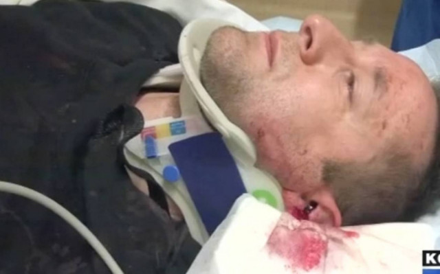 Επίθεση σε Αμερικανό κωμικό με ρόπαλο του μπέιζμπολ