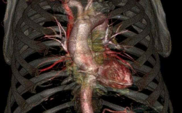 Αξονική τομογραφία νέας γενιάς: Δε χρειάζεται να είστε ακίνητοι