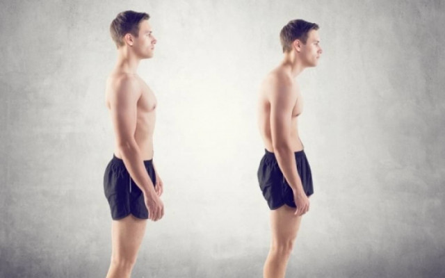 Σκολίωση: Συμπτώματα, διάγνωση, αντιμετώπιση