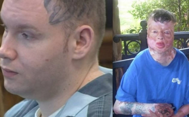 ΗΠΑ: Καταδικάστηκε το «τέρας» που βίασε και έκαψε ζωντανό 8χρονο