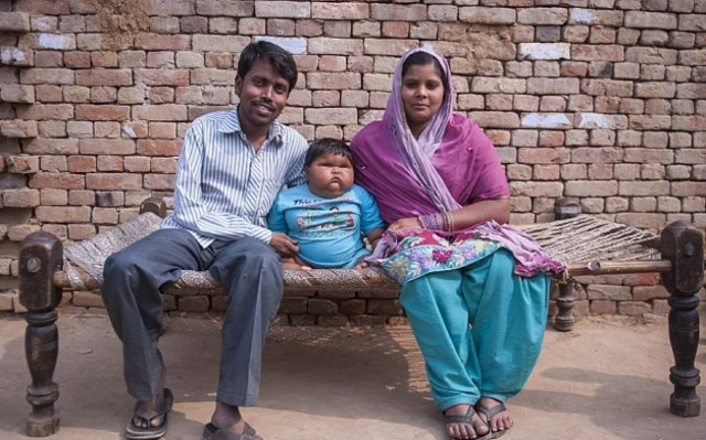 Μωρό 10 μηνών ζυγίζει... 20 κιλά! (photos)