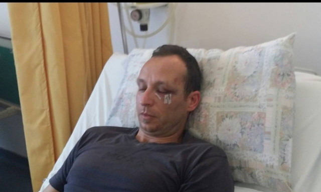 Χανιά: Ψήφισμα συμπαράστασης στο γιατρό που δέχτηκε επίθεση