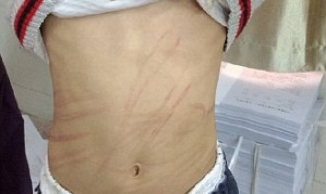 Μαστίγωνε το θετό γιο της γιατί δεν ήξερε το... παραμύθι του Πινόκιο (photos)