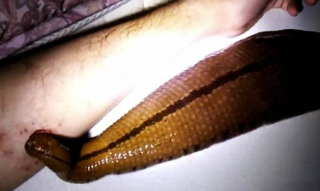 Έχει για κατοικίδιο μία... βδέλλα και την ταΐζει με το αίμα του! (video)