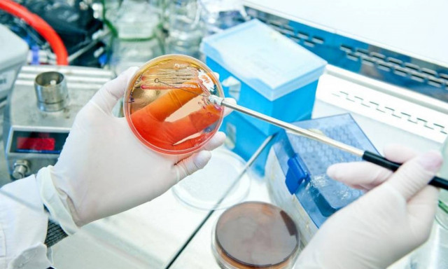 Αμερικάνικη γκάφα: Στρατιωτική εγκατάσταση έστειλε ενεργό βάκιλο του άνθρακα σε εργαστήρια