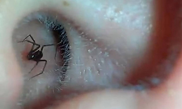 Ανατριχιαστικό: Δείτε τι κρυβόταν μέσα στο αυτί του (video)