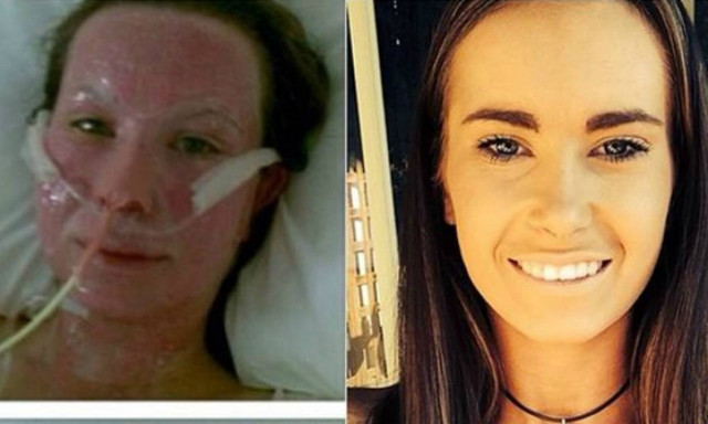 H νεαρή γυναίκα που ξεγέλασε το θάνατο 2 φορές μέσα σε μια εβδομάδα