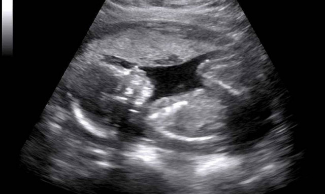 Η φωτογραφία του «στριμωγμένου» μωρού που ξεσήκωσε το διαδίκτυο! (photo)