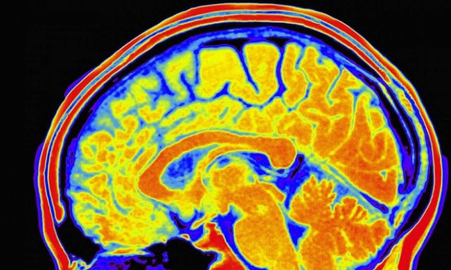 Google is ruining our memories, study claims