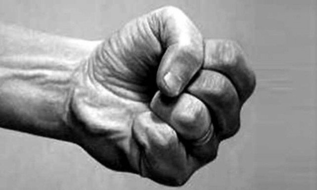 Λάρνακα: Έπεσε άγριο ξύλο-2 τραυματίες