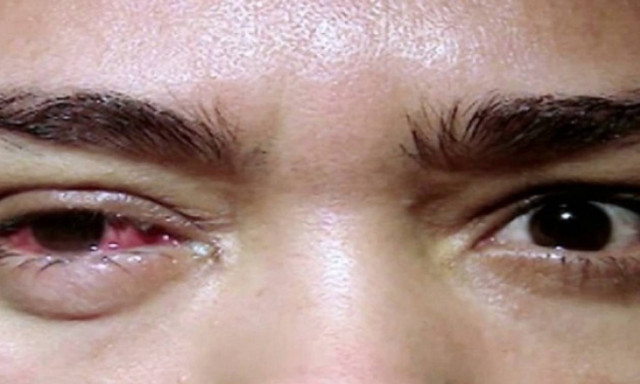 Η γυναίκα με τα κρυστάλλινα δάκρυα (εικόνες)