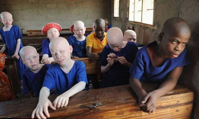 Μαλάουι: Καθηγητής σκόπευε να πουλήσει αλμπίνο μαθήτρια για να την ακρωτηριάσουν