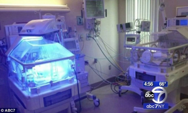 Δίδυμα γεννήθηκαν με 18 μέρες διαφορά